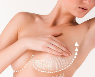 Cirurgia plástica das mamas
